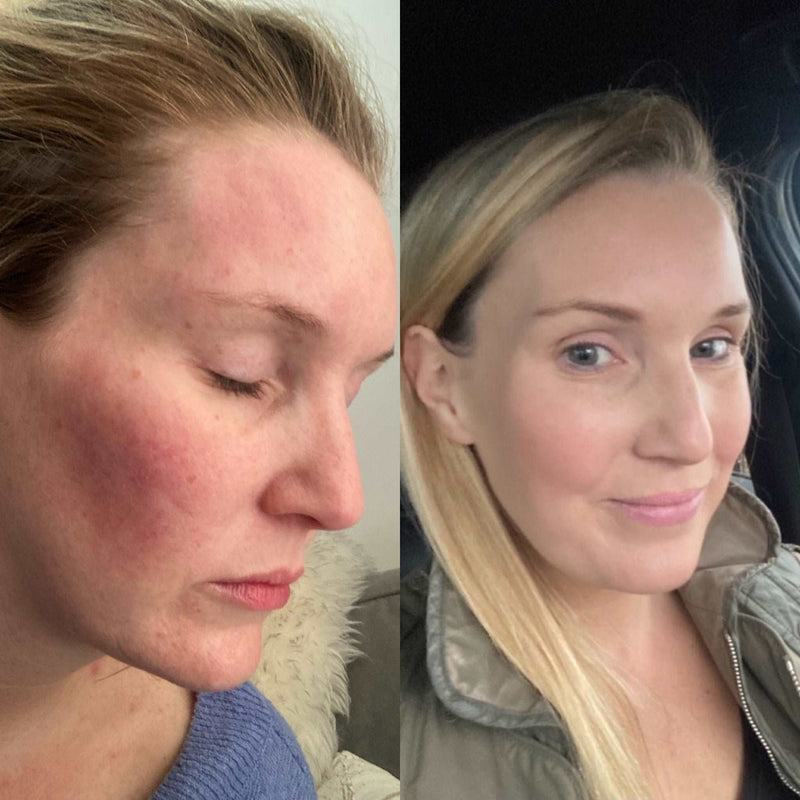 Olive & Avocado Illuminating Skincare Serum - 50ml